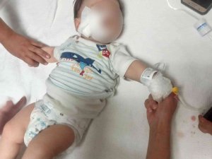 Yörük Şenliği’nde Feci Olay: Atın Isırdığı Bebek Ağır Yaralandı