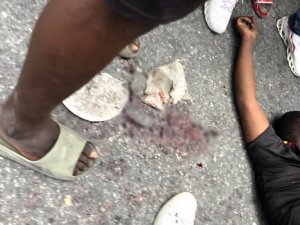 Haiti’de Hükümete Karşı Yapılan Protestolarda 1 Kişi Hayatını Kaybetti