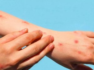 “Domates Gribinin Kontrol Altına Alınması Zor Görünüyor”