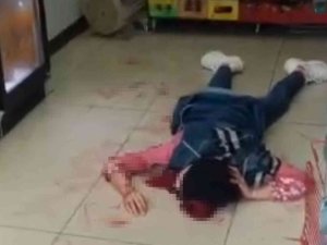 Güpegündüz Cadde Ortasında Dehşeti Yaşadılar