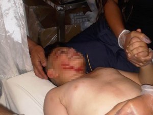 Köpeğin Saldırdığı Çocuk Hastanelik Oldu
