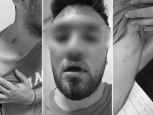 Tıp Fakültesi Öğrencilerine Emlakçıdan Darp Ve Tehdit İddiası