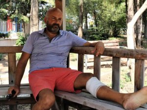 Çalınan Köpeğini Kurtarmak İsterken Bıçaklanıp Ölümden Döndü
