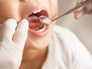 Süt Dişleri Düşeceği Zamana Kadar Korunmalı