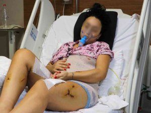 Eski Erkek Arkadaşının Bıçakladığı Burcu Yaşam Mücadelesini Kazandı