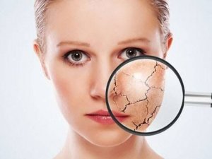 Hassas Cildi Olanlar Aman Dikkat