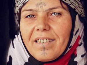 Fıstık Bahçesinde Otomobilin Çarptığı Kadın Hayatını Kaybetti