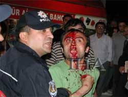 Samsun'da silahlı saldırı 4 yaralı