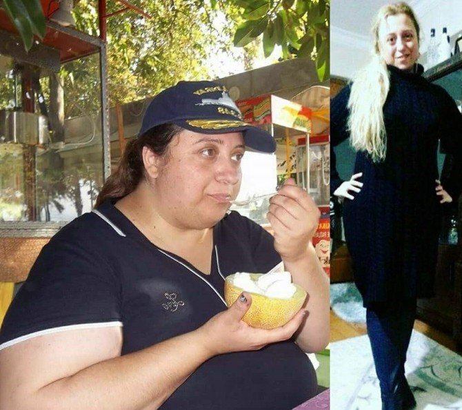 Bir Yılda 70 Kilo Verdi, Hayatı Değişti