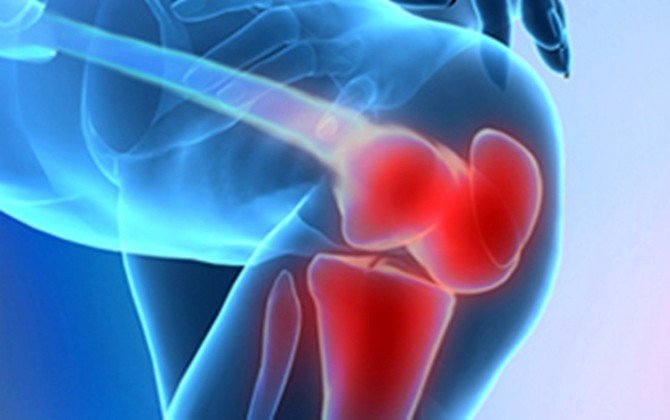 Protez Ameliyatı Sonrası Fizik Tedavi Büyük Önem Taşıyor