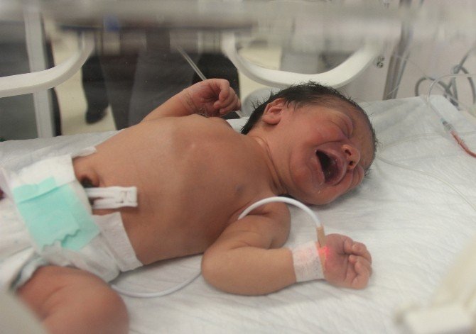 2 Günlük Kalp Hastası Bebek Ambulans Uçakla İstanbul’a Sevk Edildi