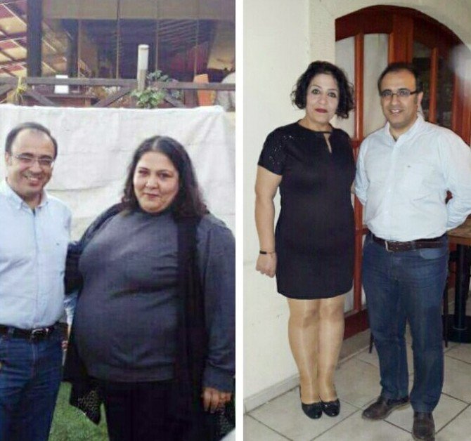 Ölümü Düşünen Anne 1 Yılda 84 Kilo Verdi