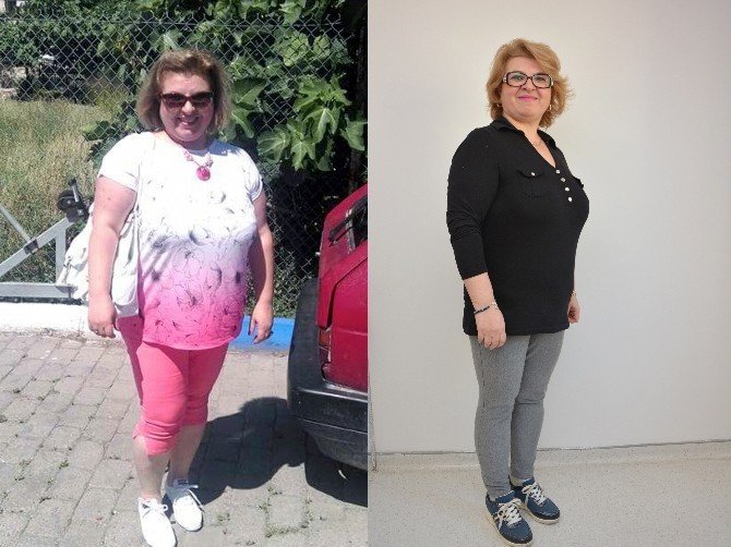 Hem Kilo Verdi Hem De Sağlığına Kavuştu