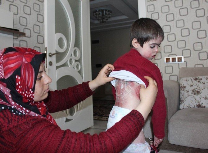 Doğuştan Yaralılar