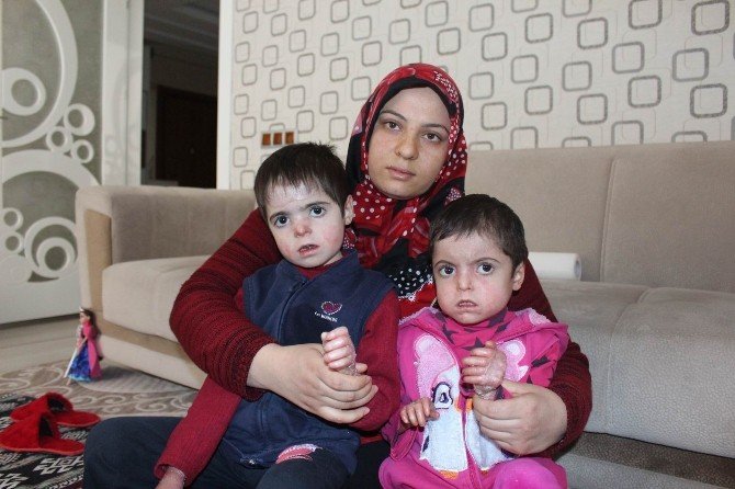 Doğuştan Yaralılar