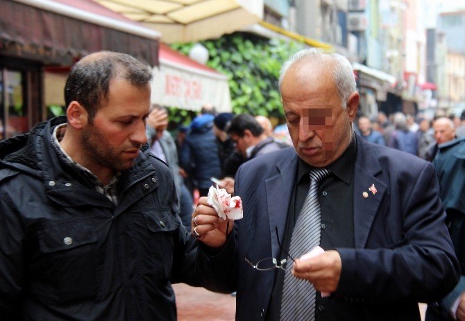 Yumruklu Saldırı: 1 Yaralı