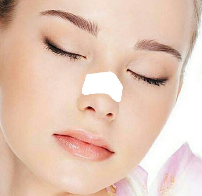 Burun Estetiğinde Dikkat Edilmesi Gerekenler