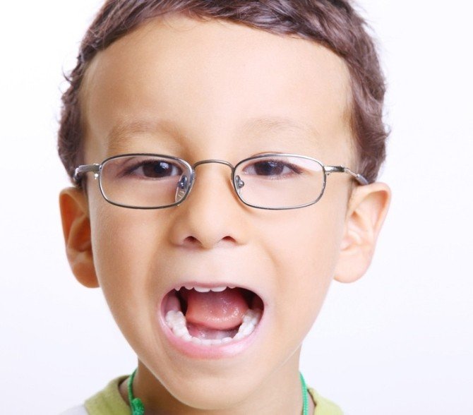 Dişlerde Estetik Tedavi Yüz Güldürüyor