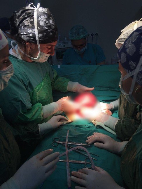 Rahminden 6,5 Kiloluk Kitle Çıkarıldı