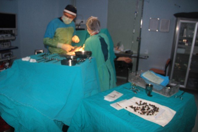 Mide Değil Taş Ocağı