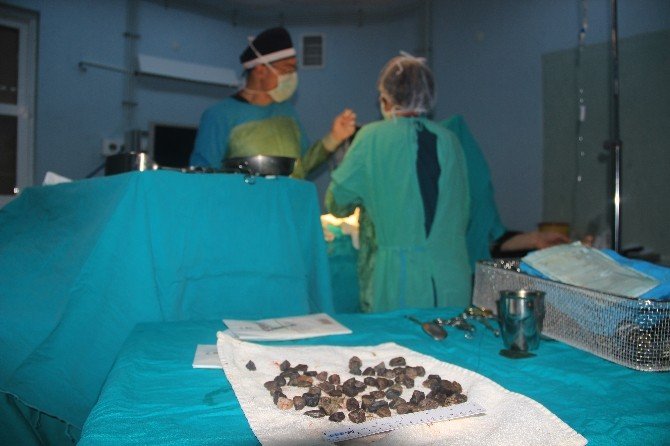 Mide Değil Taş Ocağı