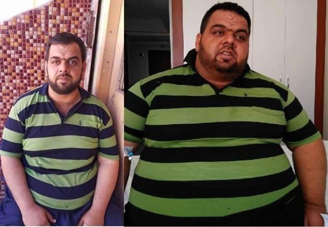 Kilolarından Namaz Kıldıramayan İmam, Ameliyatla 5 Ayda 90 Kilo Verdi