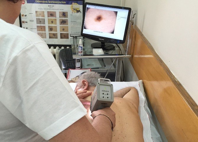 Bursa’daki Liselerde Deri Kanseri Seferberliği