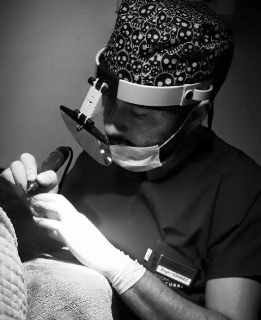 Saç Ekiminde Türkiye Tercih Ediliyor