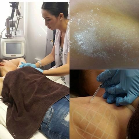 Botoksun Depresyona İyi Geldiği Kanıtlandı