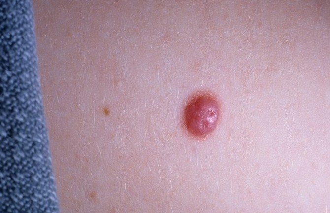 Benlerdeki Bu Değişimlere Dikkat