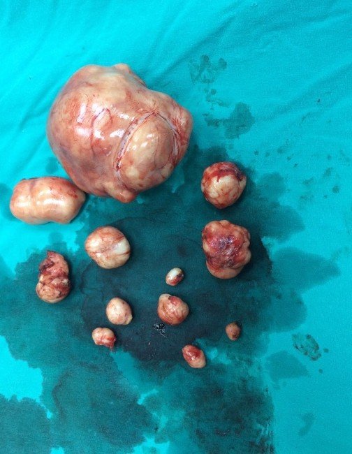 Rahminden 12 Adet Ur Çıktı