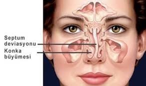 Tıkalı Burunla Yaşamayın