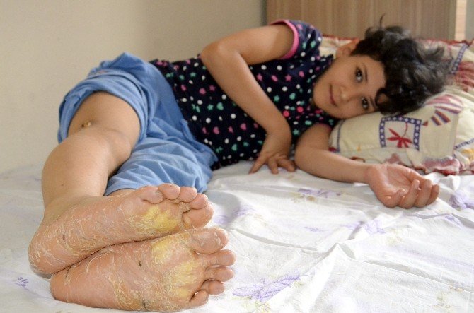 8 Yaşındaki Beyza’nın Hastalığına Teşhis Konulamıyor