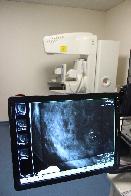 Bu Cihazla Meme Kanseri Önceden Teşhis Edilecek