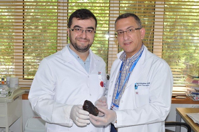 16 Yaşındaki Kızın Midesinden 190 Gram Taş Çıktı