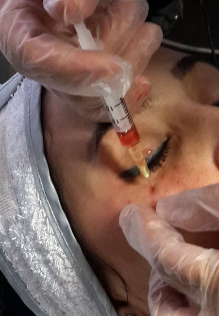 Göz Altı Morluğunun 7 Suçlusu