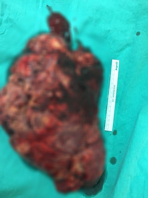 Türkiye’de İlk Defa Böylesiyle Karşılaştılar