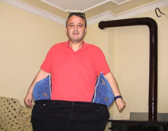 Midesine Kelepçe Taktırarak Kilolarından Kurtuldu