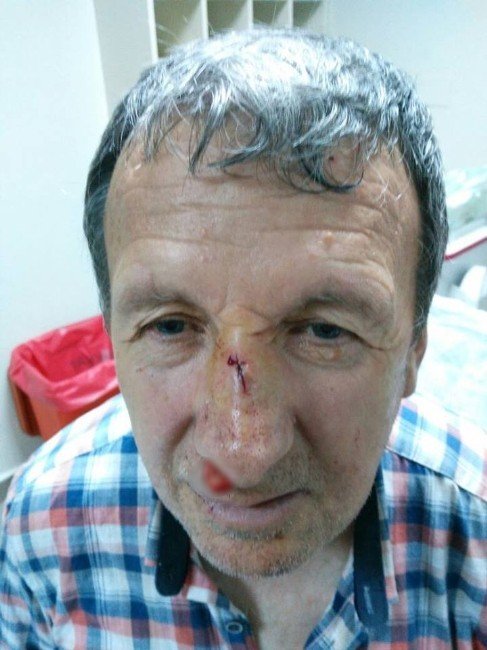 Bolu’da Gazeteciye Yumruklu Saldırı