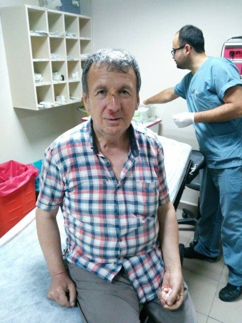 Bolu’da Gazeteciye Yumruklu Saldırı
