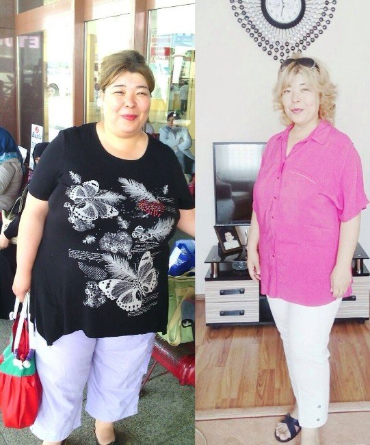 142 Kilodan 95 Kiloya Düştü