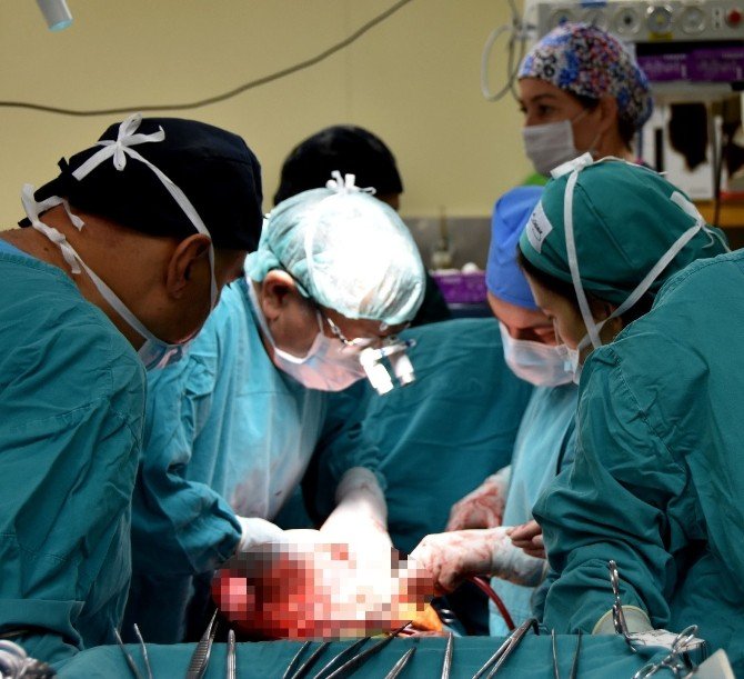 14 Yaşındaki Çocuktan 3.6 Kilo Tümör Çıkartıldı