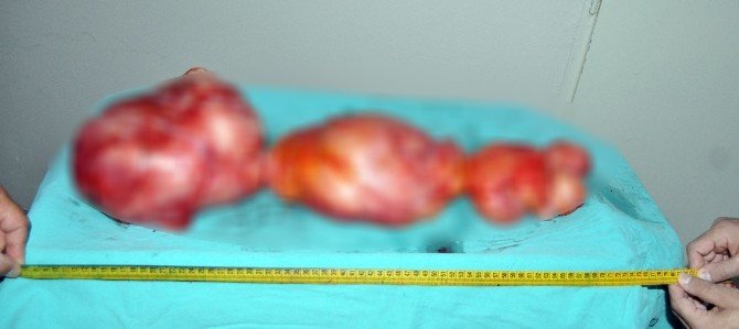 Tıp Literatürüne Geçecek Vaka