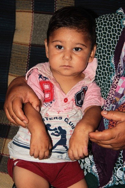 Isırarak Kendine Zarar Veren Bebeğin Ailesi Yardım İstedi