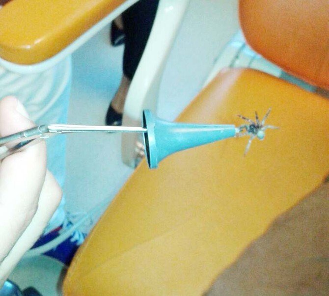 Kulağından Canlı Örümcek Çıktı