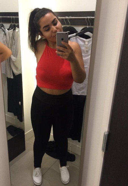 Aile Boyu Obezite Ameliyatı Oldular