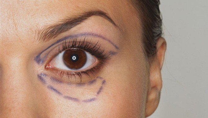 Göz Çevresi Sorunları Yaşlı Gösteriyor