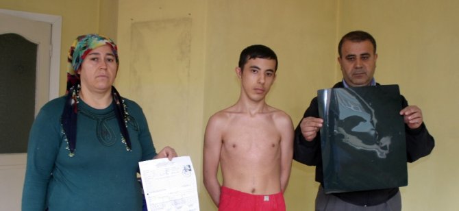 17 Yılda 17 Kez Ameliyat Oldu