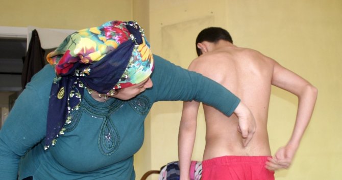 17 Yılda 17 Kez Ameliyat Oldu