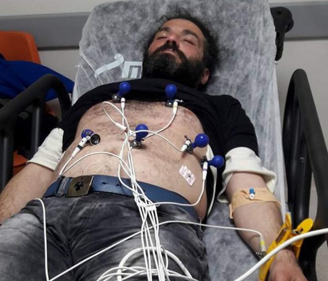 Oturan Adam Hastaneye Kaldırıldı